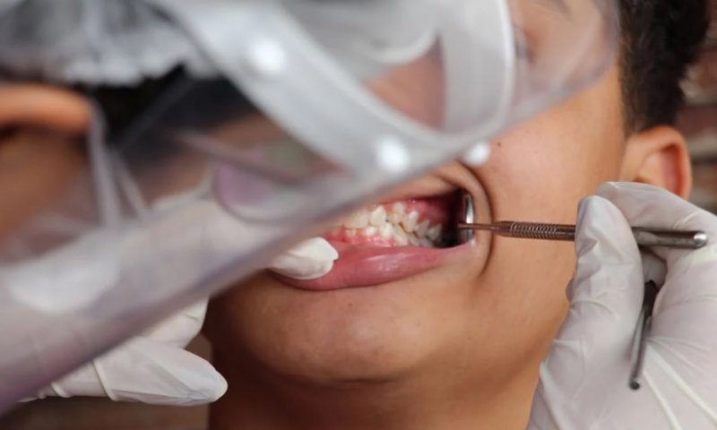 Brasil Sorridente: como funciona programa que garante atendimento odontológico gratuito no SUS